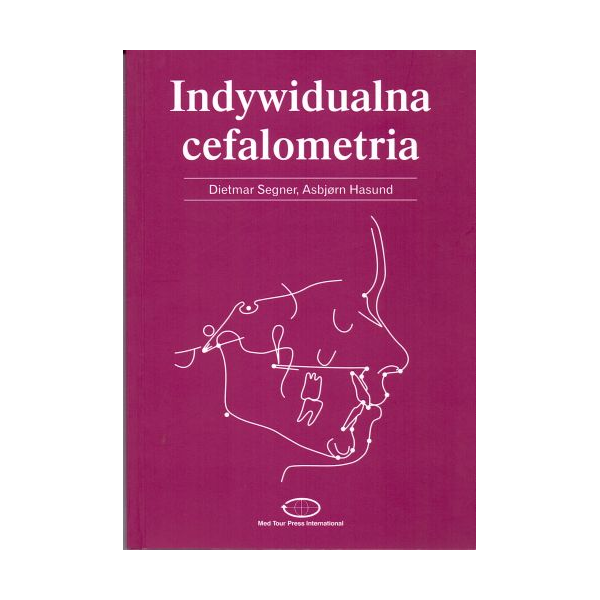 Indywidualna cefalometria