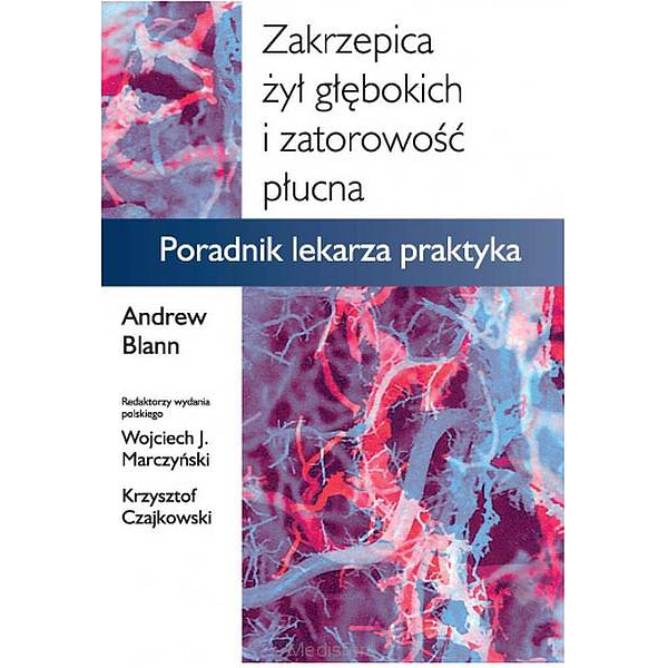 Zakrzepica żył głębokich i...