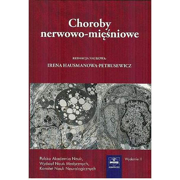 Choroby nerwowo-mięśniowe