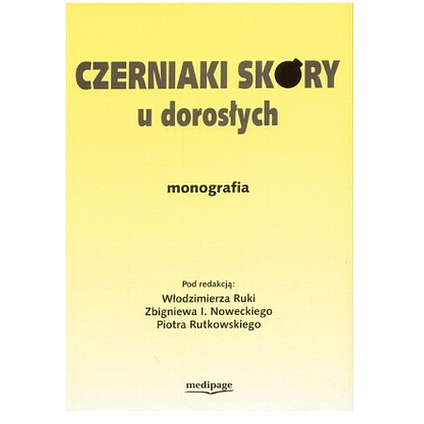 Czerniaki skóry u dorosłych...