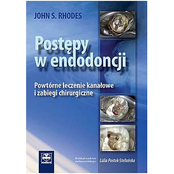 Postępy w endodoncji...