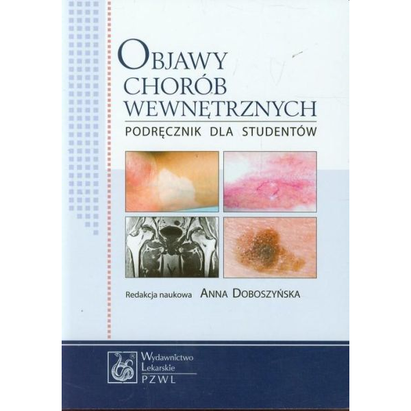 Objawy chorób wewnętrznych