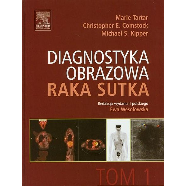 Diagnostyka obrazowa raka...