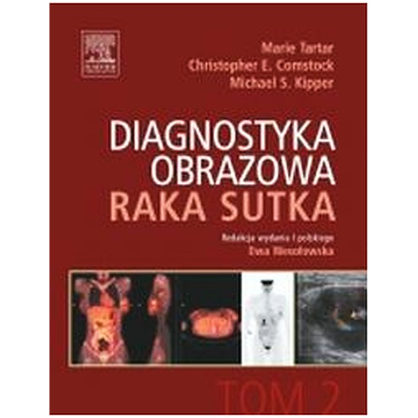 Diagnostyka obrazowa raka...