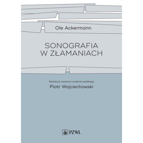 Sonografia w złamaniach