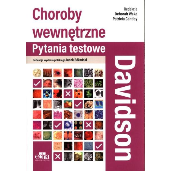 Davidson Choroby wewnętrzne...