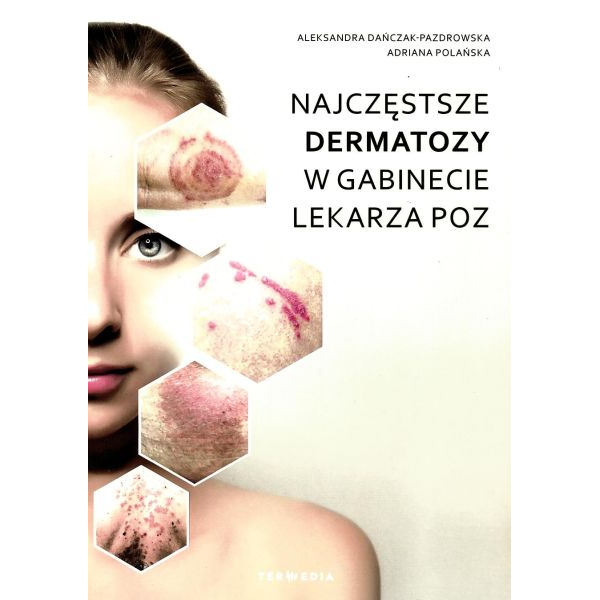 Najczęstsze dermatozy w...