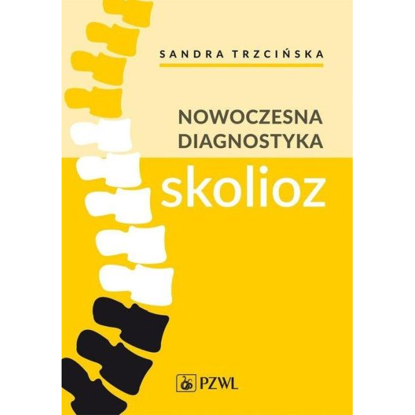 Nowoczesna diagnostyka skolioz