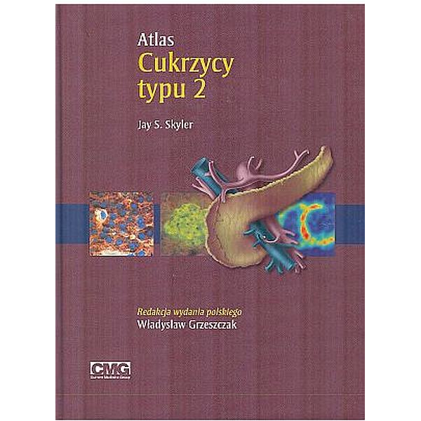 Atlas cukrzycy typu 2