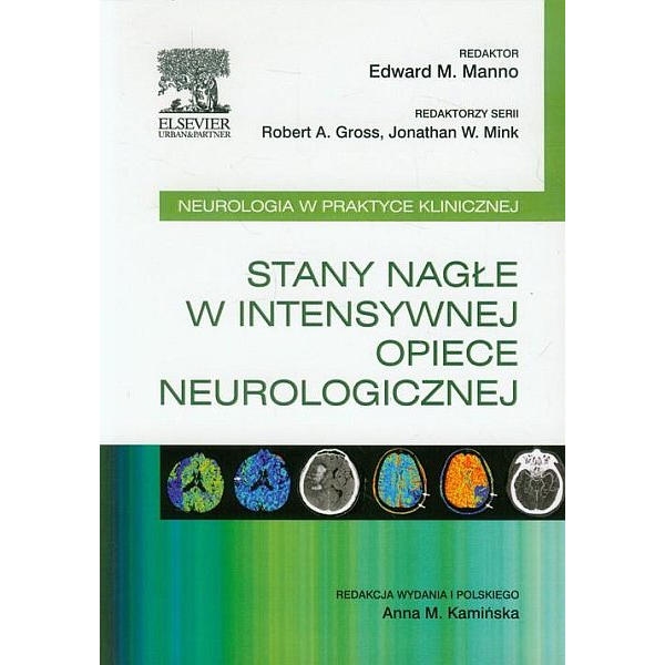 Stany nagłe w intensywnej opiece neurologicznej