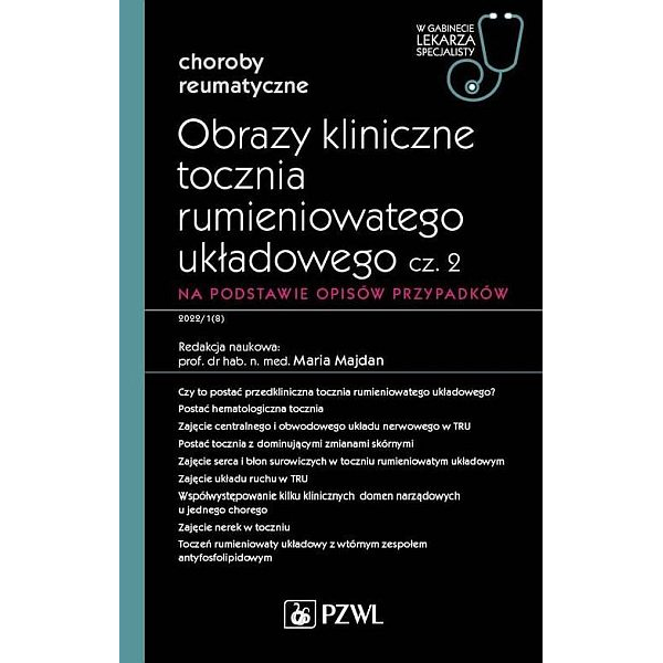 Obrazy kliniczne tocznia rumieniowatego układowego Część 2