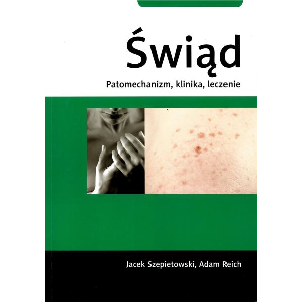Świąd Patomechanizm,...