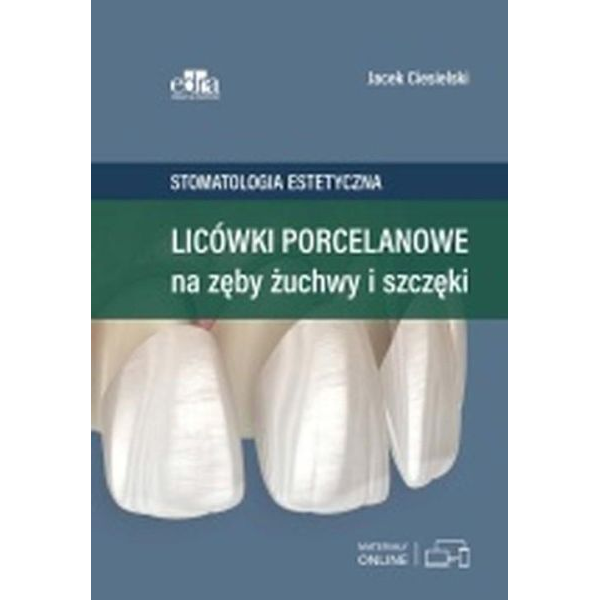 Licówki porcelanowe na zęby żuchwy i szczęki