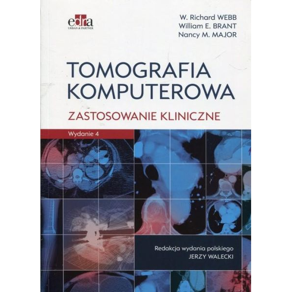 Tomografia komputerowa...