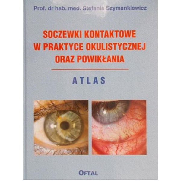 Soczewki kontaktowe w praktyce okulistycznej oraz powikłania. Atlas