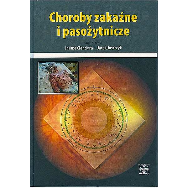 Choroby zakaźne i pasożytnicze