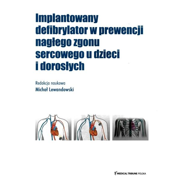 Implantowany defibrylator w...