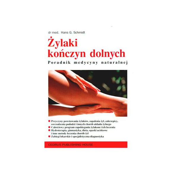 Żylaki kończyn dolnych...