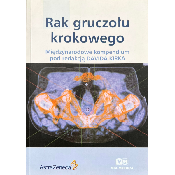 Rak gruczołu krokowego