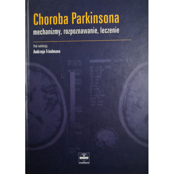 Choroba Parkinsona Mechanizmy, rozpoznawanie, leczenie