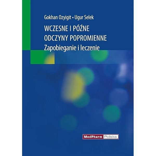 Wczesne i późne odczyny popromienne Zapobieganie i leczenie