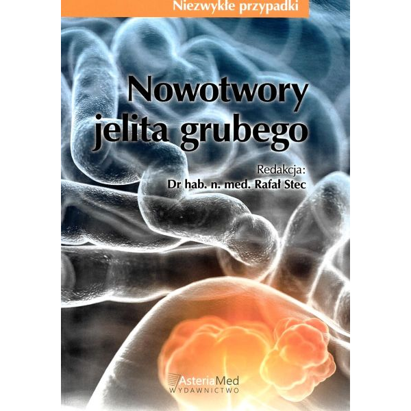 Nowotwory jelita grubego....