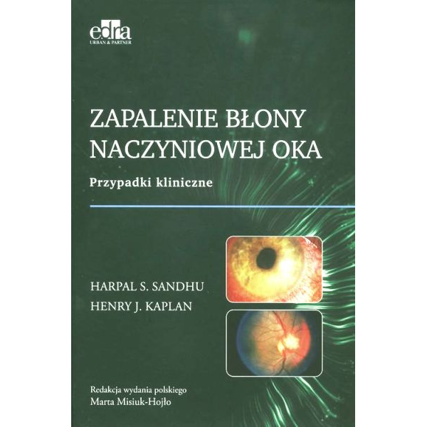 Zapalenie błony naczyniowej...