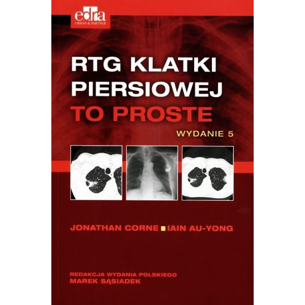 RTG klatki piersiowej TO...