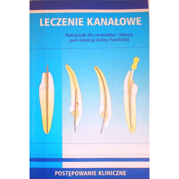 Leczenie kanałowe...