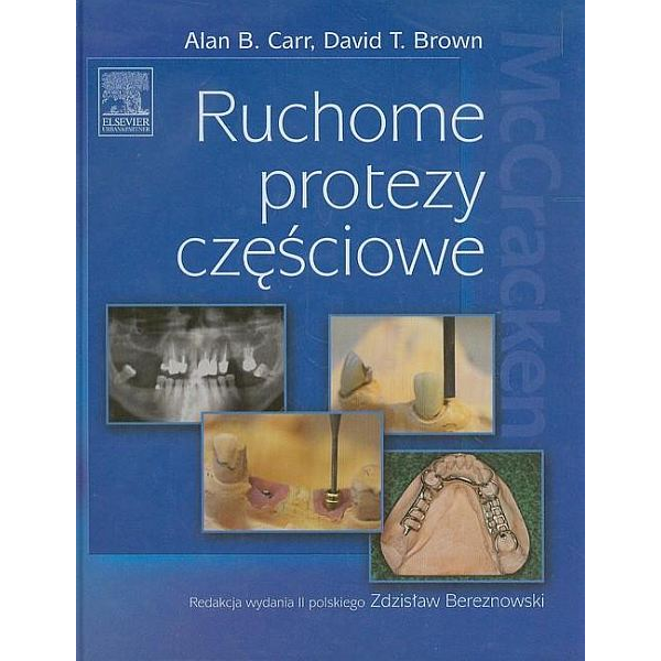 Ruchome protezy częściowe...