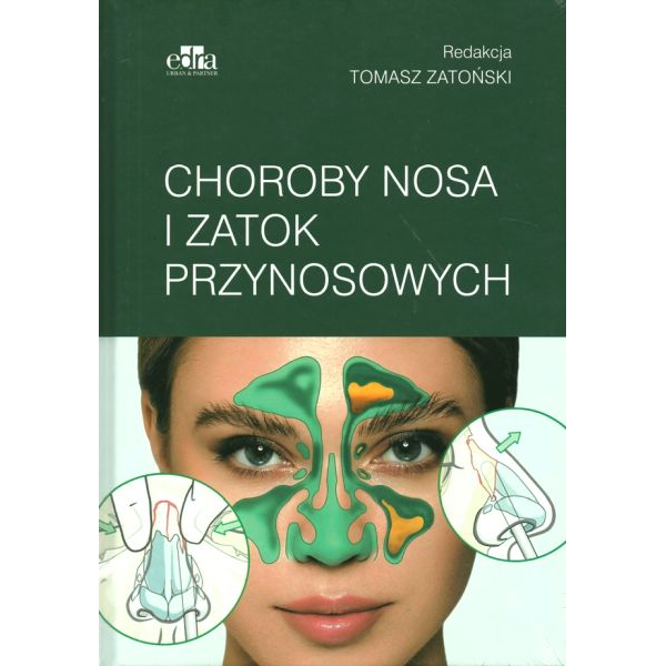 Choroby nosa i zatok...