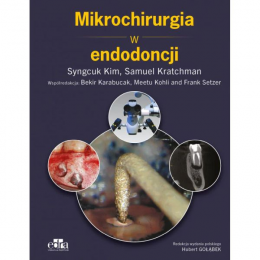 Mikrochirurgii w endodoncji