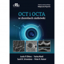 OCT I OCTA w chorobach siatkówki