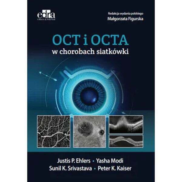 OCT I OCTA w chorobach siatkówki