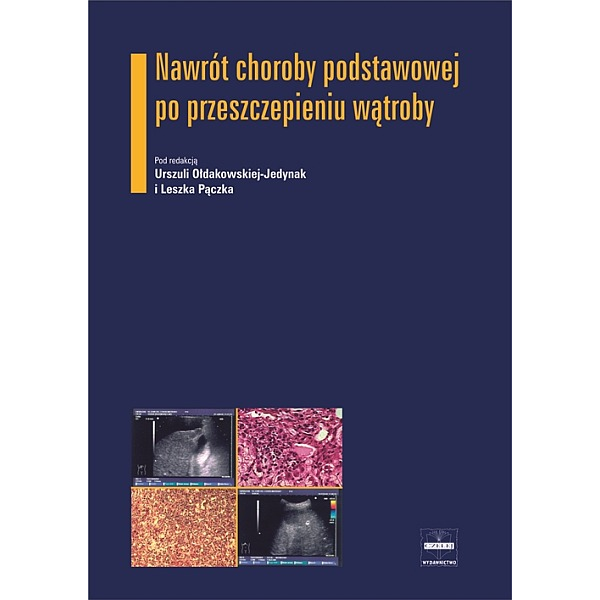 Nawrót choroby podstawowej po przeszczepieniu wątroby Nawrót choroby podstawowej po przeszczepieniu wątroby