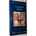 Fungal Nail Infection Pocket Picture Guides (wersja angielska)