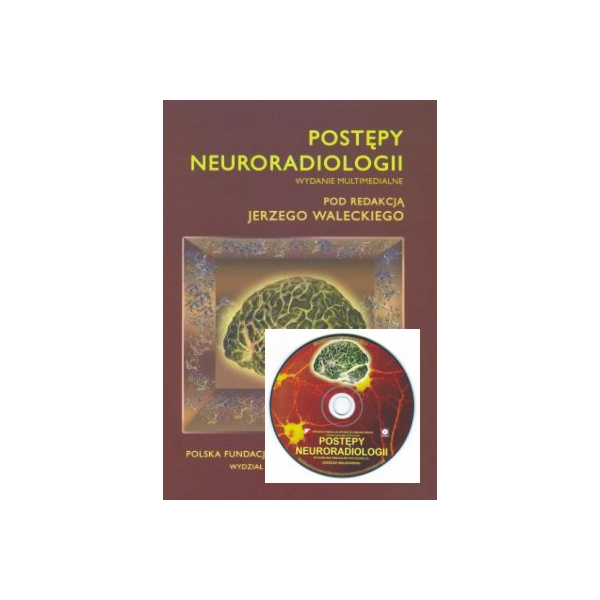 Postępy neuroradiologii (z CD) Wydanie multimedialne Postępy neuroradiologii (z CD) Wydanie multimedialne