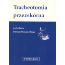 Tracheotomia przezskórna