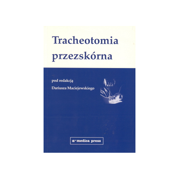 Tracheotomia przezskórna