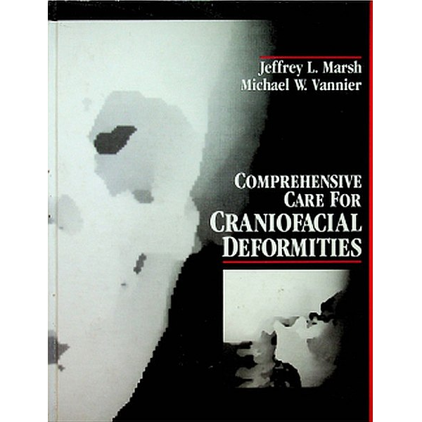 Comprehensive Care For Craniofacial Deformities