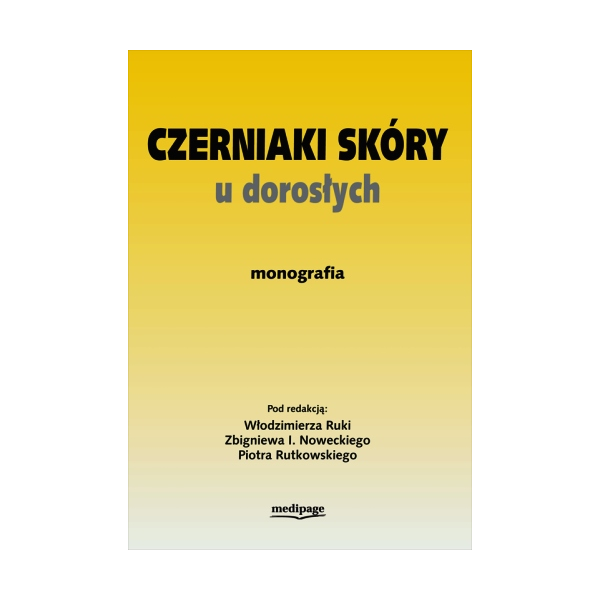 Czerniaki skóry u dorosłych monografia