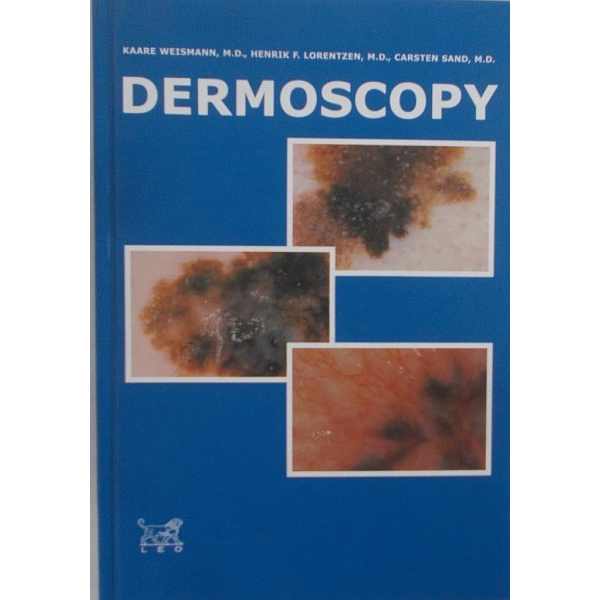 Dermoscopy