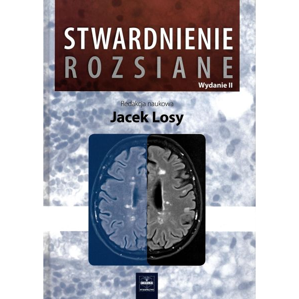 Stwardnienie rozsiane