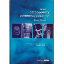 Atlas osteoporozy pomenopauzalnej