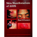 Skin Manifestations of AIDS
