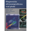 Diagnostyka ultrasonograficzna wad plodu