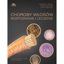 Choroby włosów .Rozpoznanie i leczenie