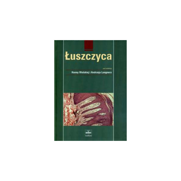 Łuszczyca