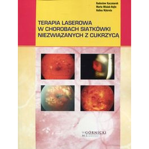 Terapia laserowa w chorobach siatkówki niezwiązanych z cukrzycą