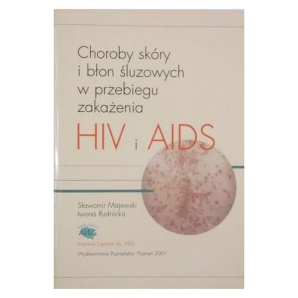 Choroby skóry i błon śluzowych w przebiegu zakażenia HIV i AIDS